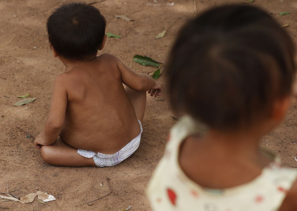 MP apura falhas no atendimento a crianças indígenas Yanomami com desnutrição grave no AM