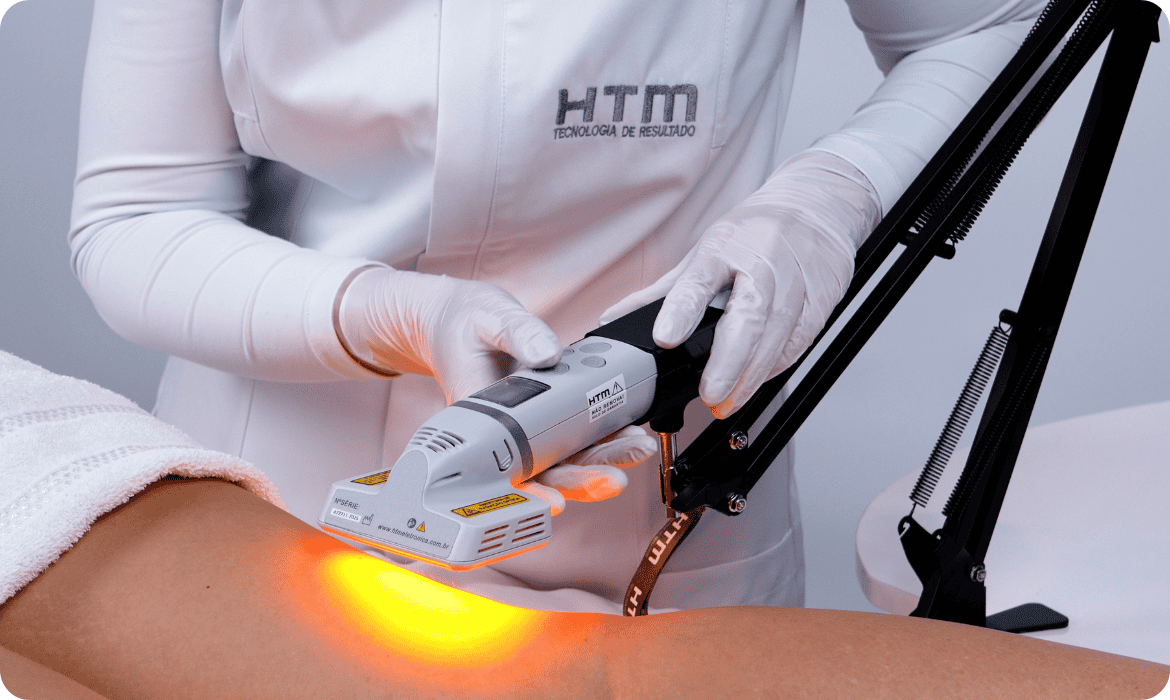 Tecnica que utiliza laser ganha espaço no tratamento complementar contra lipedema