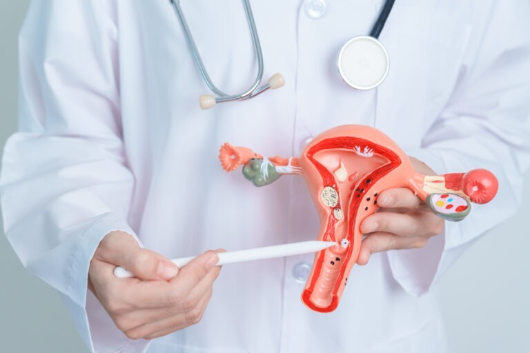 Diagnóstico precoce e novos tratamentos garantem fertilidade de mulheres com mioma