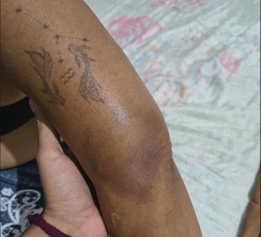 Professora e filho relatam agressão em escola já denunciada por tortura contra alunos em Manaus