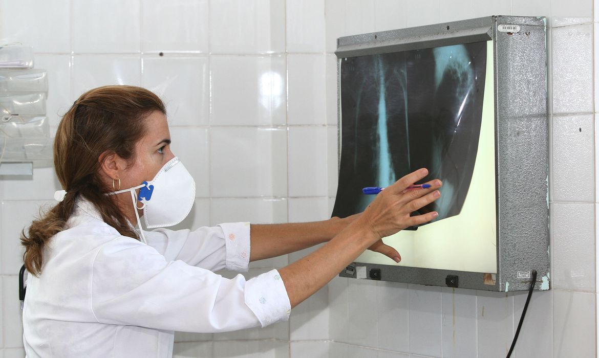Casos de tuberculose aumentam em Manaus e capital tem a maior taxa de incidência da doença do país