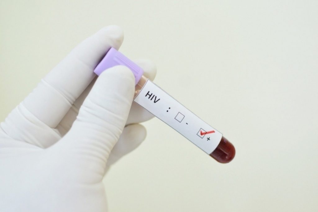 Dezembro Vermelho: ações de prevenção e conscientização sobre HIV/Aids iniciam no AM